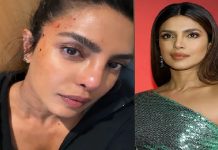 پریانکا چوپڑا فلم کی شوٹنگ کے دوران زخمی